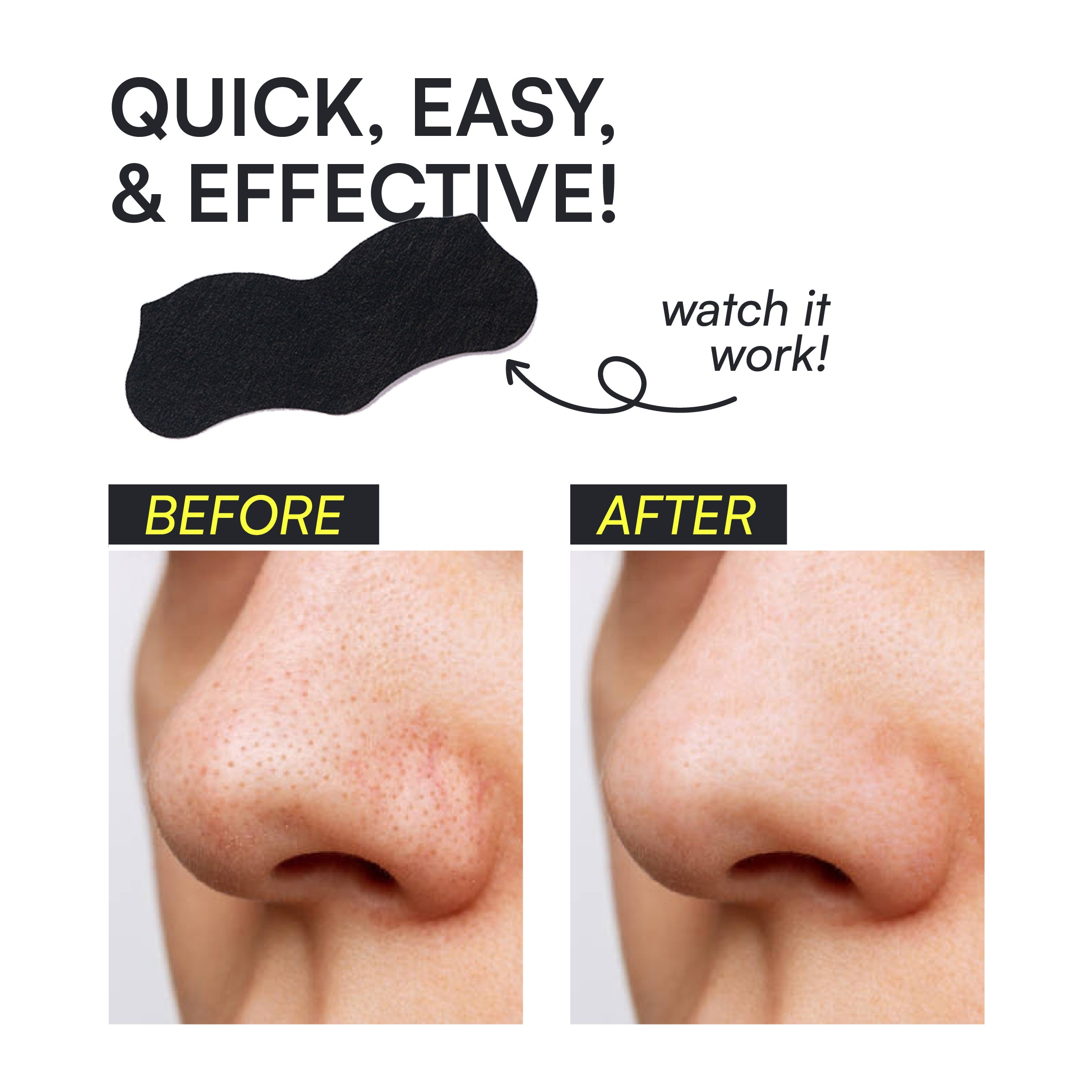 Charcoal Nose Strips